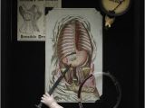 Morbid Birthday Cards Morbid Anatomy Greeting Card Surgery Time